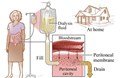 Tìm hiểu vấn đề lọc máu