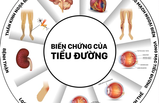 Bệnh tiểu đường