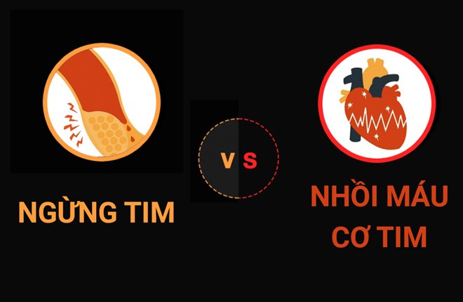 Phân biệt giữa ngừng tim và nhồi máu cơ tim