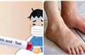 Axit uric là nguồn cơn gây ra nhiều bệnh nguy hiểm
